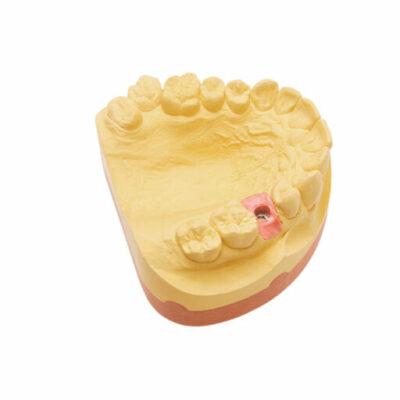 Majesthetik Gingiva-Scan - Coffret